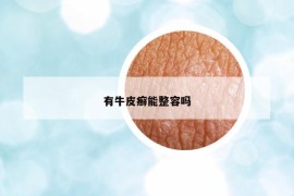有牛皮癬能整容嗎