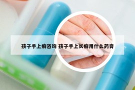 孩子手上癬咨詢 孩子手上長癬用什么藥膏
