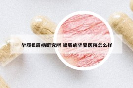 華履銀屑病研究所 銀屑病華夏醫(yī)院怎么樣