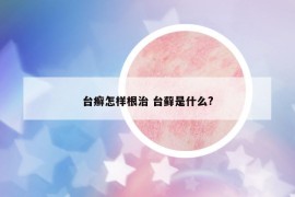 臺癬怎樣根治 臺蘚是什么?