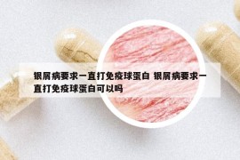 銀屑病要求一直打免疫球蛋白 銀屑病要求一直打免疫球蛋白可以嗎