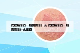 皮膚癬忌口一般需要忌什么 皮膚癬忌口一般需要忌什么東西
