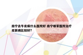 南寧去牛皮癬什么醫(yī)院好 南寧哪家醫(yī)院治療皮膚病比較好?