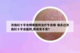 濟南紅十字會博愛醫(yī)院治療牛皮癬 誰去過濟南紅十字會醫(yī)院,費用貴不貴?