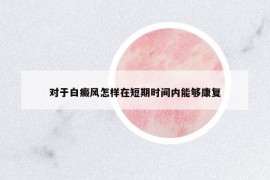 對于白癜風(fēng)怎樣在短期時(shí)間內(nèi)能夠康復(fù)