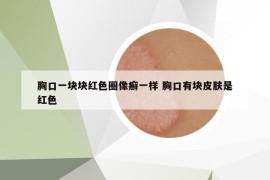 胸口一塊塊紅色圈像癬一樣 胸口有塊皮膚是紅色