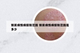 銀屑病慢病報(bào)銷范圍 銀屑病慢病報(bào)銷范圍是多少