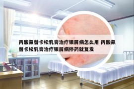 丙酸氟替卡松乳膏治療銀屑病怎么用 丙酸氟替卡松乳膏治療銀屑病停藥就復(fù)發(fā)