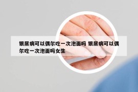 銀屑病可以偶爾吃一次泡面嗎 銀屑病可以偶爾吃一次泡面嗎女生