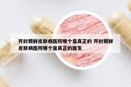 開封朝鮮皮膚病醫(yī)院哪個是真正的 開封朝鮮皮膚病醫(yī)院哪個是真正的醫(yī)生