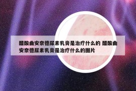 醋酸曲安奈德尿素乳膏是治療什么的 醋酸曲安奈德尿素乳膏是治療什么的圖片