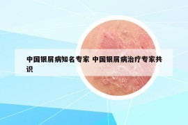 中國銀屑病知名專家 中國銀屑病治療專家共識