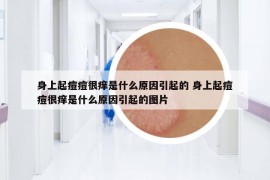 身上起痘痘很癢是什么原因引起的 身上起痘痘很癢是什么原因引起的圖片