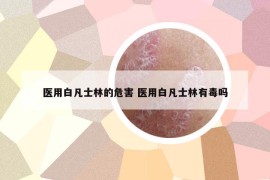 醫(yī)用白凡士林的危害 醫(yī)用白凡士林有毒嗎