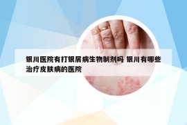 銀川醫(yī)院有打銀屑病生物制劑嗎 銀川有哪些治療皮膚病的醫(yī)院