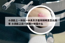 小孩臉上一塊白一塊黑出汗是特別明顯怎么回事 小孩臉上白一塊黑一塊是什么