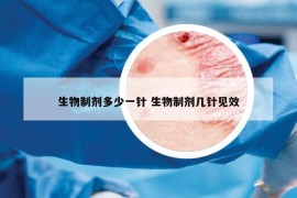 生物制劑多少一針 生物制劑幾針見效