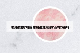 銀屑病泡礦物質 銀屑病泡澡加礦晶有效果嗎