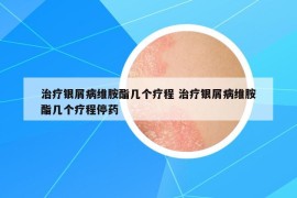 治療銀屑病維胺酯幾個(gè)療程 治療銀屑病維胺酯幾個(gè)療程停藥