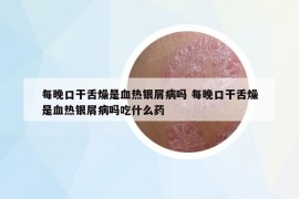 每晚口干舌燥是血熱銀屑病嗎 每晚口干舌燥是血熱銀屑病嗎吃什么藥