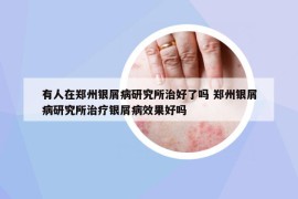 有人在鄭州銀屑病研究所治好了嗎 鄭州銀屑病研究所治療銀屑病效果好嗎