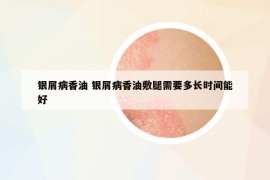 銀屑病香油 銀屑病香油敷腿需要多長時間能好