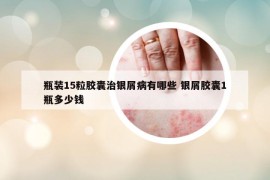 瓶裝15粒膠囊治銀屑病有哪些 銀屑膠囊1瓶多少錢