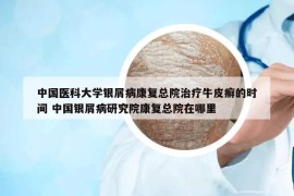 中國(guó)醫(yī)科大學(xué)銀屑病康復(fù)總院治療牛皮癬的時(shí)間 中國(guó)銀屑病研究院康復(fù)總院在哪里