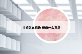 頑癬怎么根治 頑癬什么意思