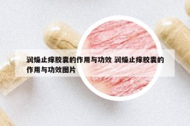 潤燥止癢膠囊的作用與功效 潤燥止癢膠囊的作用與功效圖片