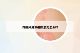 白癜風(fēng)用生姜擦患處怎么樣
