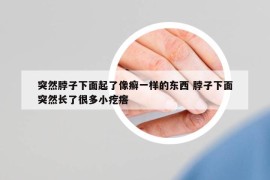突然脖子下面起了像癬一樣的東西 脖子下面突然長(zhǎng)了很多小疙瘩