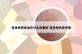 百多邦藥膏治療什么效果好 百多邦藥膏作用