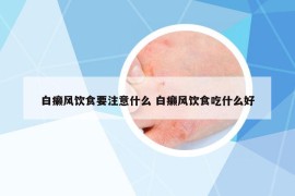 白癩風(fēng)飲食要注意什么 白癩風(fēng)飲食吃什么好