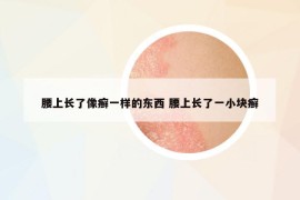 腰上長(zhǎng)了像癬一樣的東西 腰上長(zhǎng)了一小塊癬