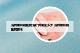 淄博銀屑病醫(yī)院治療費用是多少 淄博銀屑病醫(yī)院排名