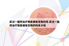 武漢一醫(yī)院治療銀屑病有生物藥嗎 武漢一醫(yī)院治療銀屑病有生物藥嗎多少錢