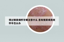 得過銀屑病懷孕要注意什么 患有銀屑病發(fā)現(xiàn)懷孕怎么辦