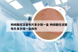 枸櫞酸托法替布片多少錢一盒 枸櫞酸托法替布片多少錢一盒尚杰