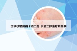 斑塊狀銀屑病卡泊三醇 卡泊三醇治療銀屑病
