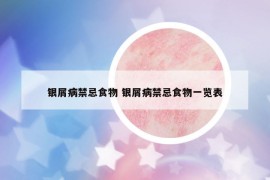 銀屑病禁忌食物 銀屑病禁忌食物一覽表
