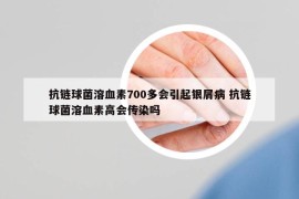抗鏈球菌溶血素700多會(huì)引起銀屑病 抗鏈球菌溶血素高會(huì)傳染嗎