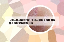 卡泊三醇軟膏和擦劑 卡泊三醇軟膏和擦劑有什么區(qū)別可以擦身上嗎