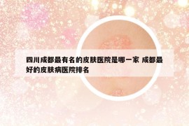 四川成都最有名的皮膚醫(yī)院是哪一家 成都最好的皮膚病醫(yī)院排名
