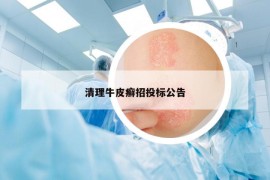 清理牛皮癬招投標(biāo)公告