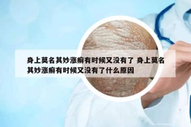 身上莫名其妙漲癬有時(shí)候又沒有了 身上莫名其妙漲癬有時(shí)候又沒有了什么原因