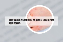 銀屑病可以吃淡水魚嗎 銀屑病可以吃淡水魚嗎百度百科