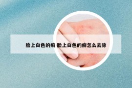 臉上白色的癬 臉上白色的癬怎么去除