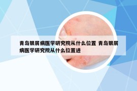 青島銀屑病醫(yī)學(xué)研究院從什么位置 青島銀屑病醫(yī)學(xué)研究院從什么位置進(jìn)