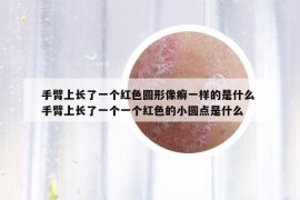 手臂上長了一個紅色圓形像癬一樣的是什么 手臂上長了一個一個紅色的小圓點是什么